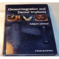 Osseointegration And Dental Implants Jokstad segunda mano  Argentina